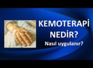 Kemoterapi: Kanser Tedavisinde İlaçla Savaş Yöntemi